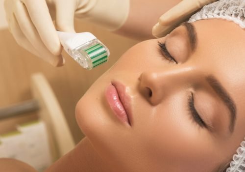 microagulhamento_Facial